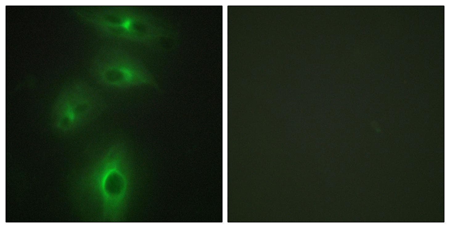 Polyclonal Rabbit anti-Human TMPRSS3 Antibody (IF, WB)