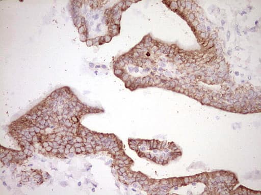 Monoclonal Mouse anti-Human Peripherin Antibody (clone OTI2D5, IHC, WB)