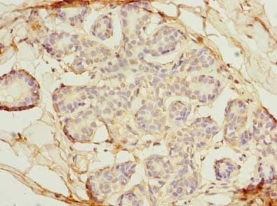 Polyclonal Rabbit anti-Human OSGIN2 Antibody (IHC, WB)