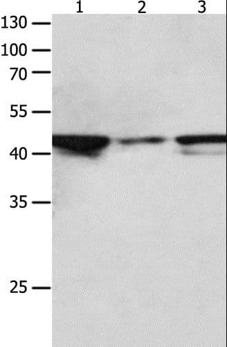 Polyclonal Rabbit anti-Human MAP2K2 / MKK2 / MEK2 Antibody (IHC, WB)