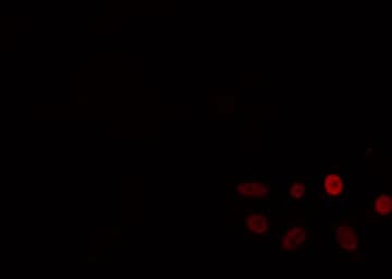 BP1 / DLX4 Antibody