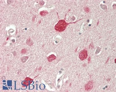 IHC-plus™ MAPK10 / JNK3 Antibody (aa342-391)