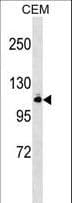 GRIK5 / KA2 Antibody (aa101-129)