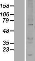 UBOX5 Protein (Over-Expression Lysate Myc-DDK (Flag))