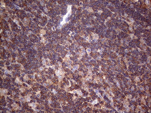 DICER1 / Dicer Antibody (aa1666-1922, clone OTI1E11)