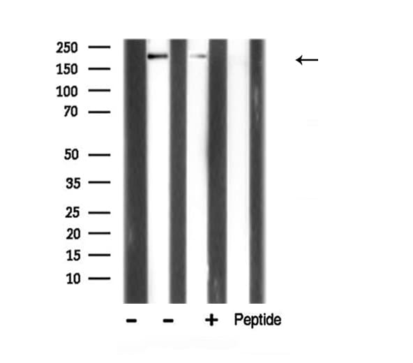 Polyclonal Rabbit anti-Human MYLK Antibody (WB)
