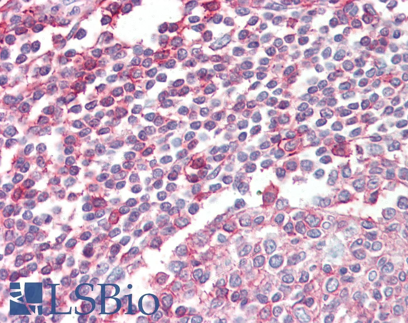 IHC-plus™ Polyclonal Goat anti-Human P40PHOX / NCF4 Antibody (aa228-238, IHC, WB)