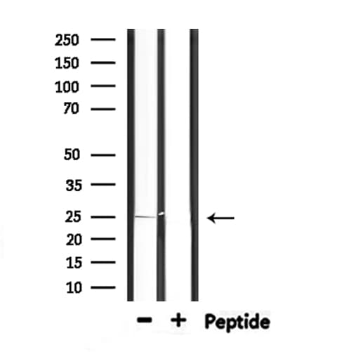 PRDX6 / Peroxiredoxin 6 Antibody