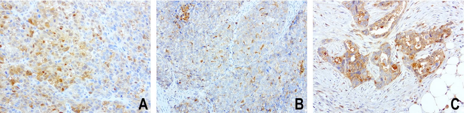 SDCBP / Syntenin Antibody (clone UMAB69)