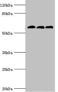 Polyclonal Rabbit anti-Human ABAT Antibody (aa29-300, IHC, WB)