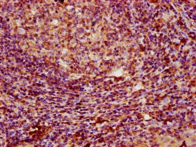 Polyclonal Rabbit anti-Human PARP3 Antibody (IHC, WB)