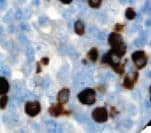 Mouse Anti-Human IgG Secondary Antibody (Ready-to-Use)