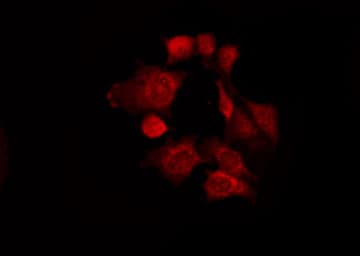 PWWP2B Antibody