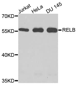 Polyclonal Rabbit anti-Human RELB Antibody (WB)