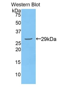 DLAT / PDC-E2 Antibody (aa374-631, Cy3)
