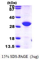 Human ERP27 Protein (Recombinant His)