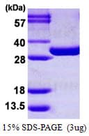 Mouse PGAM1 Protein (Recombinant His)