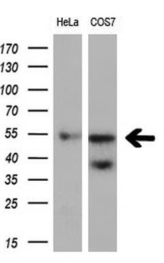 Monoclonal Mouse anti-Human FOXO4 / AFX1 Antibody (clone OTI5A5, aa206-505, WB)