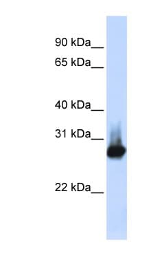 BCAP31 / BAP31 Antibody (C-Terminus)