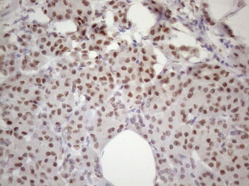 TP53BP1 / 53BP1 Antibody (aa1-300, clone OTI2H6)