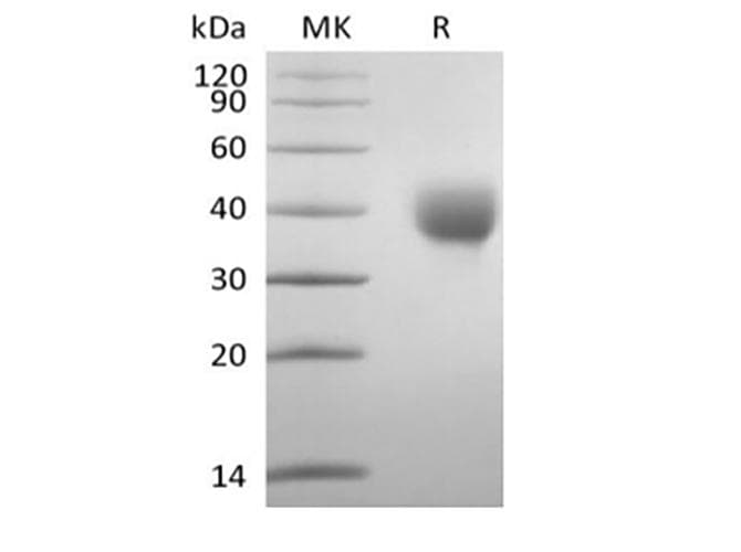 Human LILRA5 Protein (Recombinant AVI-6His, C-terminus)