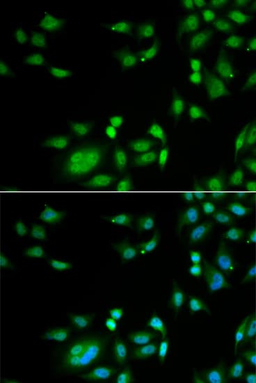 INTS10 Antibody