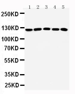 HTS1 / ST5 Antibody (aa571-586)