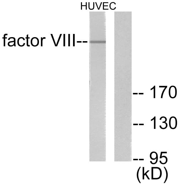 Polyclonal Rabbit anti-Human F8 / FVIII / Factor VIII Antibody (aa2161-2210, WB)