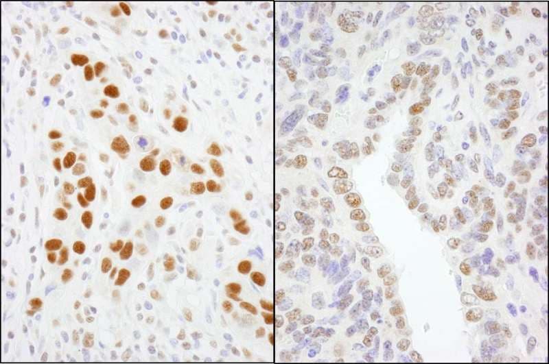 GTF2I / TFII I Antibody (aa935-985)