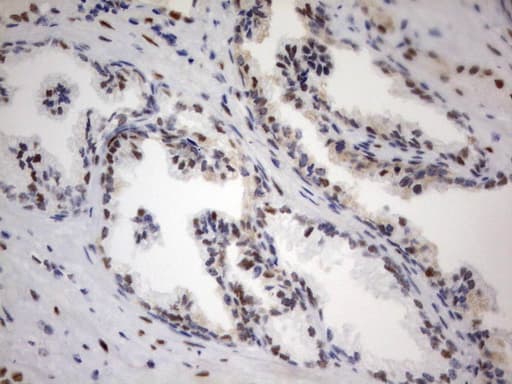 PARN Antibody (aa1-266, clone UMAB143)