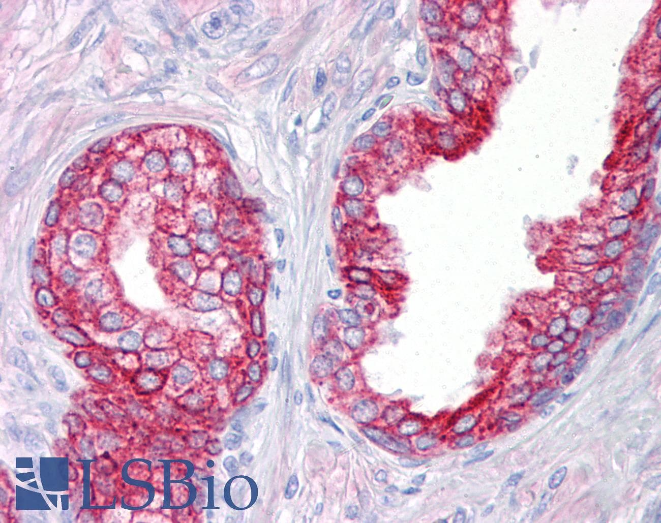 PathPlus™ KRT8 / CK8 / Cytokeratin 8 Antibody (clone 35-beta-H11)