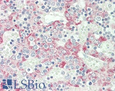 Polyclonal Rabbit anti-Mouse CLEC1B / CLEC-2 Antibody (N-Terminus, IHC, WB)