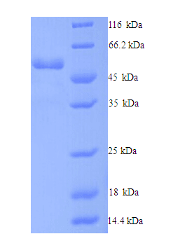 Human DCTN4 / Dynactin 4 Protein (Recombinant His)