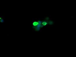 CTAG1B / NY-ESO-1 Antibody (clone OTI4B6, Carrier-free)