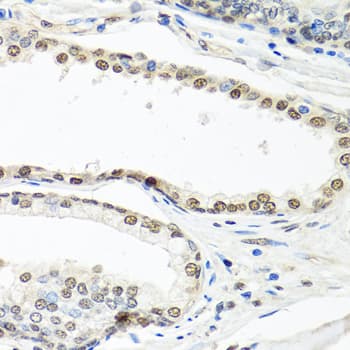 ELAVL1 / HUR Antibody