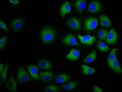 Polyclonal Rabbit anti-Human CHST3 Antibody (IHC, IF)