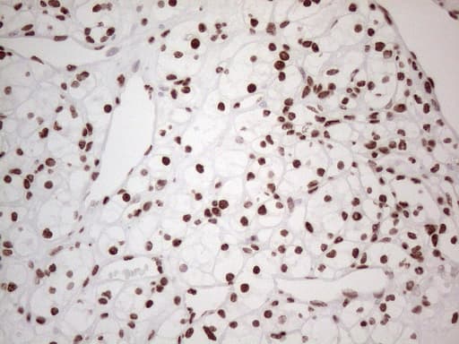 Monoclonal Mouse anti-Human HNRNPL / hnRNP L Antibody (clone OTI4E5, aa270-502, IHC)