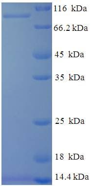 Hepatitis E Virus HEV Capsid Protein (Recombinant His-SUMO)