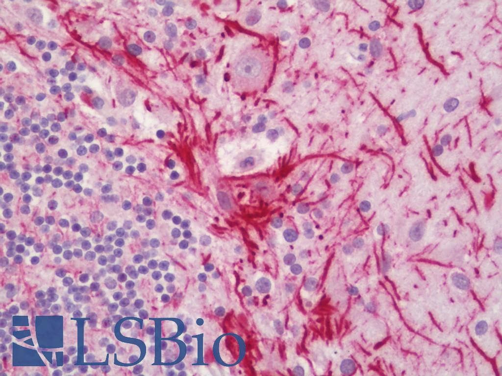 IHC-plus™ Polyclonal Rabbit anti-Human CCR5 Antibody (aa292-341, IHC)