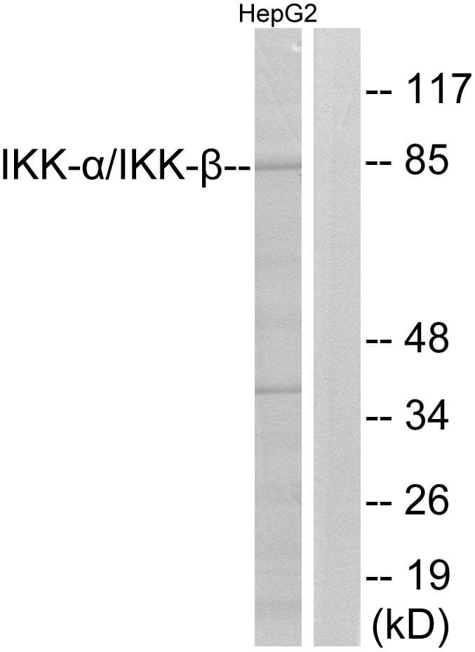 Polyclonal Rabbit anti-Human CHUK / IKKA / IKK Alpha Antibody (phospho-Ser180/181, IHC, IF, WB)
