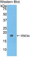 CEA / Carcinoembryonic Antigen Antibody (aa93-221)