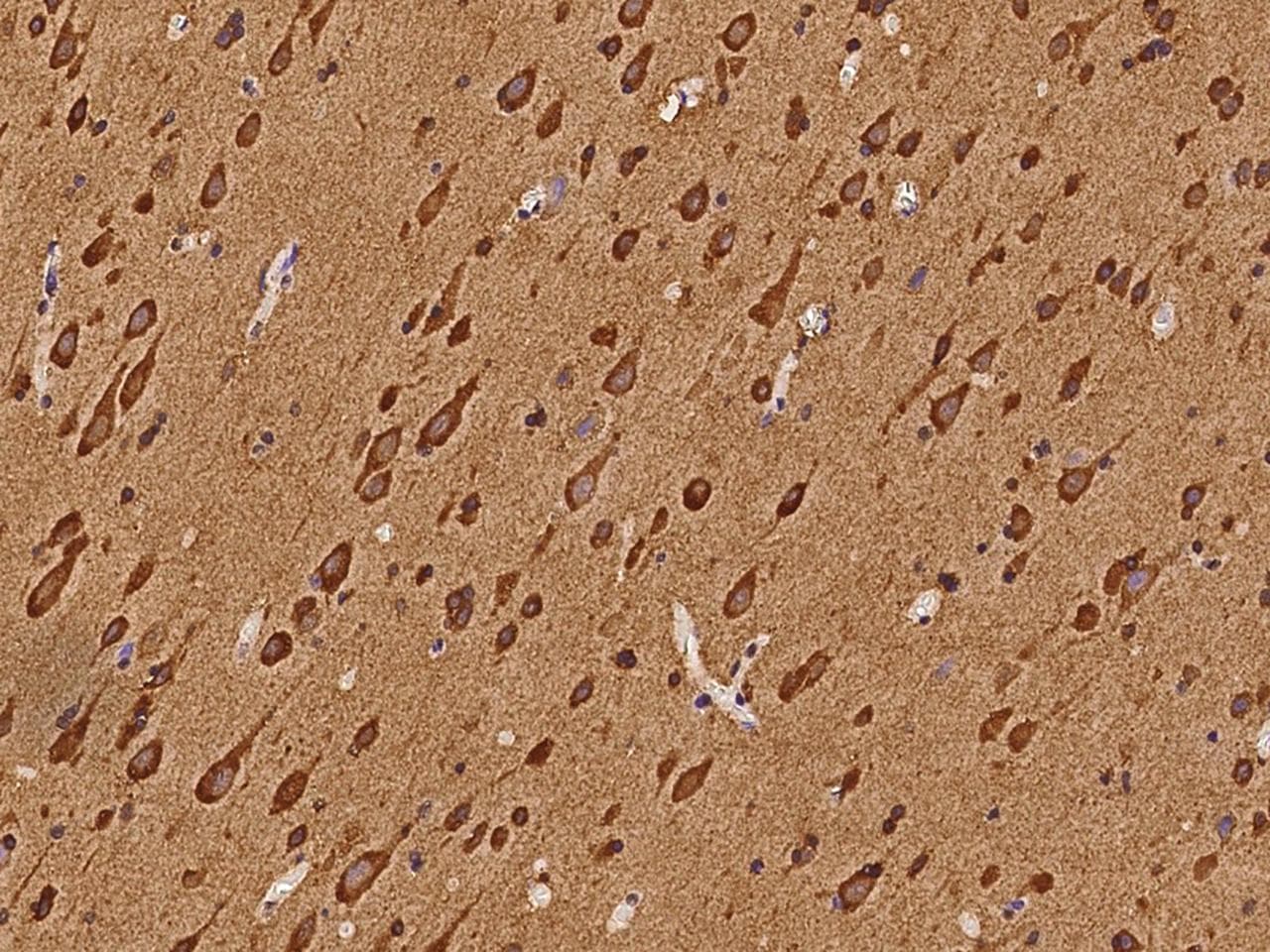 SEMA4G / Semaphorin 4G Antibody