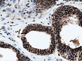 NT5DC1 Antibody (clone OTI3H2)