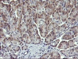 MAPK13 / p38delta Antibody (clone OTI12C3)