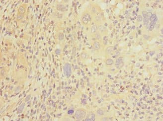 CLEC1B / CLEC-2 Antibody