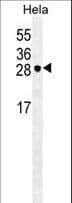 IHC-plus™ EIF4E Antibody