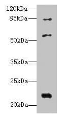 Polyclonal Rabbit anti-Human IFIX / PYHIN1 Antibody