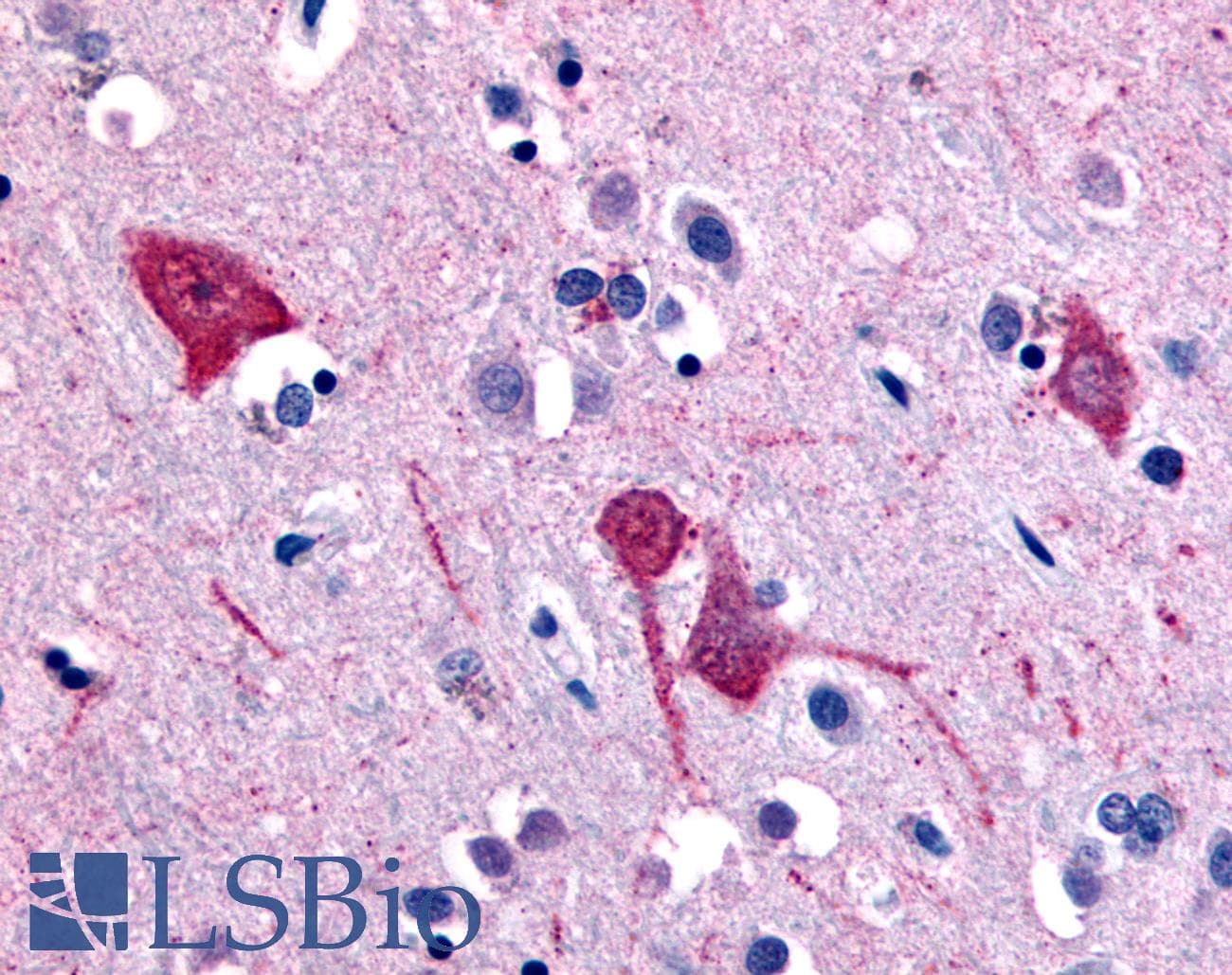 IHC-plus™ Polyclonal Rabbit anti-Human SLC5A11 / SMIT2 Antibody (Extracellular Domain, IHC)