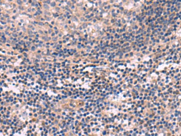 KCNT1 / KCa4.1 Antibody
