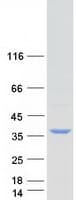 Human FAM192A / Nip30 Protein (Recombinant Myc-DDK (Flag))
